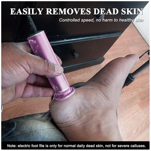 Powerful electric foot - electric, file