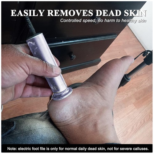 Professional electric foot - professional,