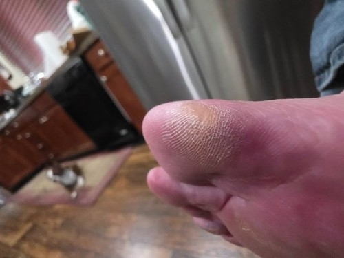 Portable electronic foot - electronic, file